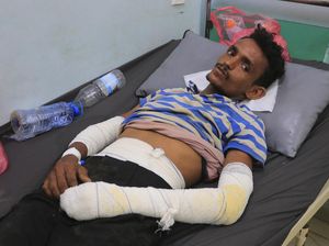 Kondisi Korban Luka Akibat Serangan Israel di Pelabuhan Yaman