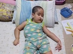 Tabahnya Bian, Anak Pengantar Galon yang Alami Komplikasi Penyakit