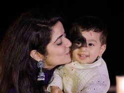 Idap Kondisi Langka, Bocah Ini Punya Tanda Lahir Tutupi Hampir Setengah Wajah