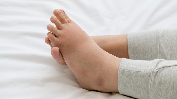 kaki bengkak saat hamil