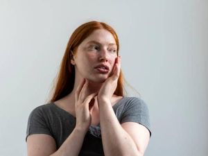 Penyakit Lupus: Gejala, Penyebab, Jenis, hingga Perawatannya