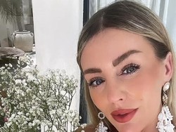 Bule Ahli Kecantikan Kecelakaan Horor di Bali, Nasibnya Viral Jadi Begini