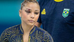 Momen Atlet Senam Artistik Jatuh dan Dahinya Terluka di Olimpiade Paris 2024