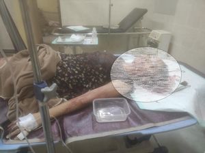 Meliani Warga Prabumulih Dibacok Pacar di Kosan, Diduga Pelaku Cemburu Meliani Warga Prabumulih Dibacok Pacar di Kosan, Diduga Pelaku Cemburu