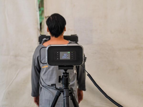 Skrining TB Gratis untuk Warga di Gedung Sate