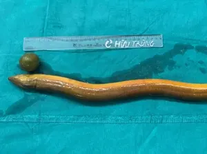 Meski Mirip Ular Belut Ternyata Sejenis Ikan, Begini Penjelasannya Meski Mirip Ular Belut Ternyata Sejenis Ikan, Begini Penjelasannya