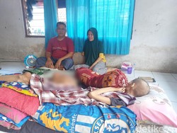 Perjuangan Wawan Hidayat Rawat Anak yang Idap Tumor Ganas