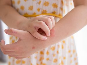 Teka-teki Penyakit Misterius di Tasikmalaya