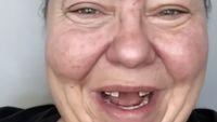 Foto: Transformasi Wanita Ompong Viral, Setelah Makeup Bak Selebriti
