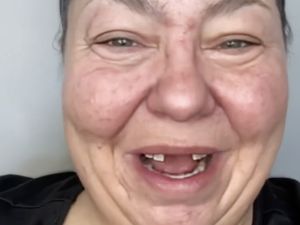 Foto: Transformasi Wanita Ompong Viral, Setelah Makeup Bak Selebriti Foto: Transformasi Wanita Ompong Viral, Setelah Makeup Bak Selebriti