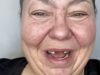 Foto: Transformasi Wanita Ompong Viral, Setelah Makeup Bak Selebriti