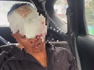 Anggota TNI yang Diserang-Dibacok Geng Motor di Medan Buta Mata Kiri Anggota TNI yang Diserang-Dibacok Geng Motor di Medan Buta Mata Kiri
