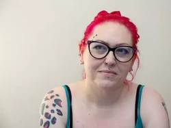 Operasi Untuk Turunkan BB, Wanita Ini Malah Tak Bisa Makan 3 Tahun