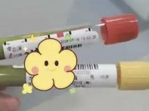 Darah Pria Ini Jadi Hijau gegara Minuman Beralkohol