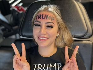 Wanita Tato Trump di Dahi Dibully, Kini Buka Penggalangan Dana untuk Hapus
