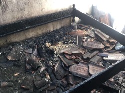 Remaja di Banyuwangi Terbakar Saat Tidur, Luka Bakarnya Capai 85%