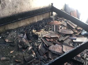 Remaja di Banyuwangi Terbakar Saat Tidur, Luka Bakarnya Capai 85% Remaja di Banyuwangi Terbakar Saat Tidur, Luka Bakarnya Capai 85%