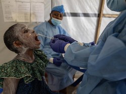 Virus Mpox Merebak di Afrika, Aliansi Wisata Afsel Jamin Turis Aman