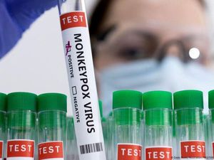 Mengenal Varian Mpox Clade 2b yang Ada di Indonesia, Seperti Apa Gejalanya? Mengenal Varian Mpox Clade 2b yang Ada di Indonesia, Seperti Apa Gejalanya?