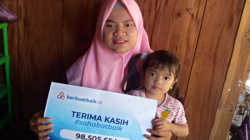 Kondisi Eliza Penderita Epidermolisis Bullosa usai Terima Donasi Sahabat Baik