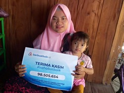 Kondisi Eliza Penderita Epidermolisis Bullosa usai Terima Donasi Sahabat Baik