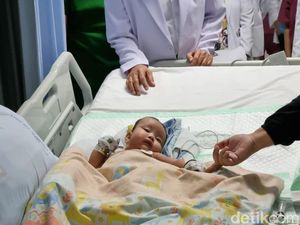 Biaya Operasi Bayi Kembar Siam Tulungagung Ditanggung Pemprov Jatim Biaya Operasi Bayi Kembar Siam Tulungagung Ditanggung Pemprov Jatim