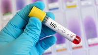 Menyamar Jadi Wanita, Pria China Tiduri Ribuan Pria dan Sebarkan HIV