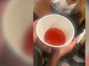 Gegara Kekeliruan Pelayan, Bocah 2 Tahun Berujung Masuk IGD