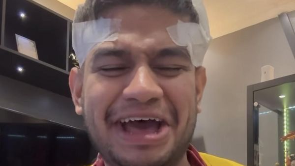 8 Foto Fadil Jaidi Jalani Tanam Rambut Pakai Bulu Dada Karena Alami Kebotakan