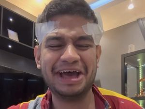 8 Foto Fadil Jaidi Jalani Tanam Rambut Pakai Bulu Dada Karena Alami Kebotakan 8 Foto Fadil Jaidi Jalani Tanam Rambut Pakai Bulu Dada Karena Alami Kebotakan