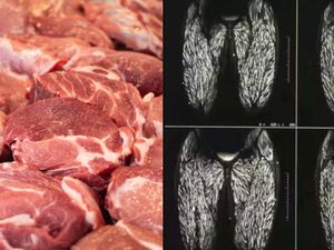 Ngeri! Tubuh Wanita Ini Dipenuhi Parasit Gegara Makan Daging Babi Mentah Ngeri! Tubuh Wanita Ini Dipenuhi Parasit Gegara Makan Daging Babi Mentah