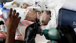 Bayi-bayi Prematur Dipindah dari RS Al-Aqsa Gaza