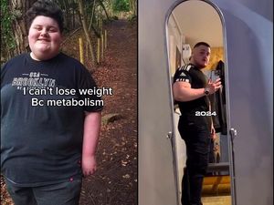 Obesitas di Umur 15 Tahun, Bobot Remaja Ini Sempat Sentuh 181 Kg sebelum Diet