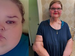 Before-After Diet Sukses Wanita di AS, BB Menyusut hingga 225 Kg