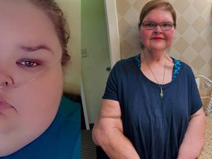 Before-After Diet Sukses Wanita di AS, BB Menyusut hingga 225 Kg Before-After Diet Sukses Wanita di AS, BB Menyusut hingga 225 Kg