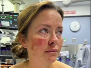 Horor! Wajah Wanita Ini Ditusuk Pria Tak Dikenal di Bandara