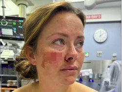 Horor! Wajah Wanita Ini Ditusuk Pria Tak Dikenal di Bandara