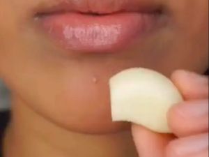 Viral di TikTok Tren Oles Bawang Putih ke Wajah, Ini Manfaatnya Viral di TikTok Tren Oles Bawang Putih ke Wajah, Ini Manfaatnya