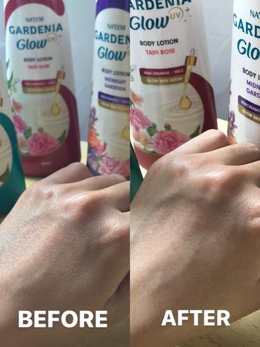Potret before & after penggunaan Gardenia Glow Serum Lotion