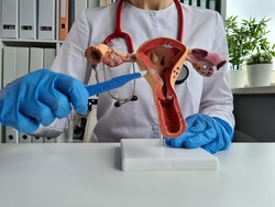 Kisah Megan, Punya Kista Raksasa karena Ogah Periksakan Perut Besarnya