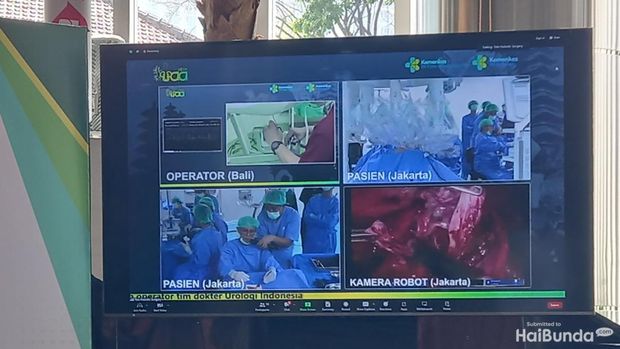 Operasi Telerobotik pertama di RSCM Kencana Jakarta