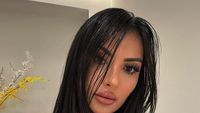 Foto Influencer 30 Kali Oplas Agar Mirip Kim Kardashian, Kini Menyesal