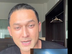 Penampilan Baru Indra Bruggman Usai Oplas di Korsel, Bagian Ini yang Berubah