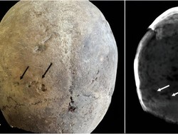 Ditemukan Sisa-sisa Narkoba di Otak Mumi Abad 17
