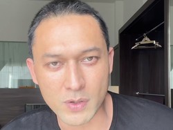 Alasan Indra Bruggman Oplas Bagian Mata Bukan karena Tak Bersyukur