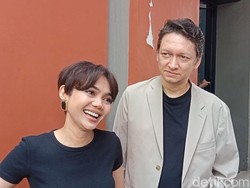 Klarifikasi Rina Nose Disebut Niat Operasi Plastik