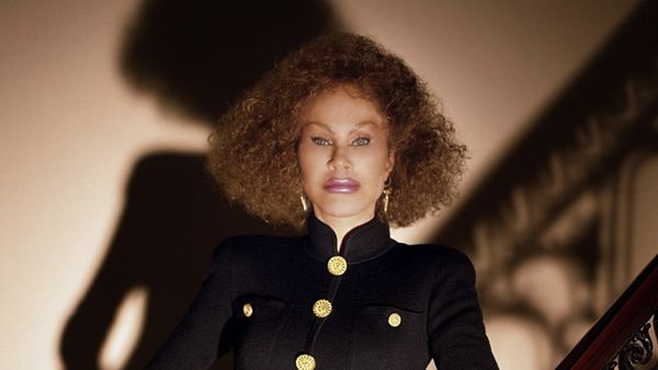 7 Foto Before After Sosialita yang Gila Oplas, Eks Suami Sebut Mirip Monster