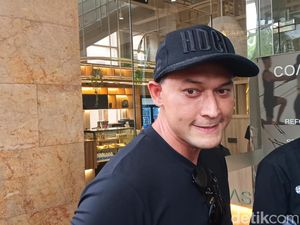 Indra Bruggman Buka soal Biaya Operasi Kantung Mata di Korea Selatan