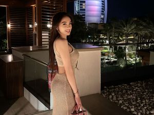 8 Foto Terbaru Angel Karamoy Makin Cantik Setelah Oplas, Bak Barbie Hidup