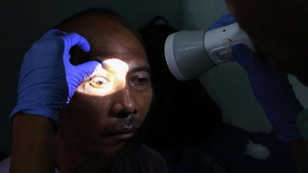 Operasi Katarak untuk Warga Tak Mampu di Medan